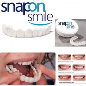 Snap-On Smile - якісні та зручні знімні вініри, прості у використанні і підійдут. . фото 2