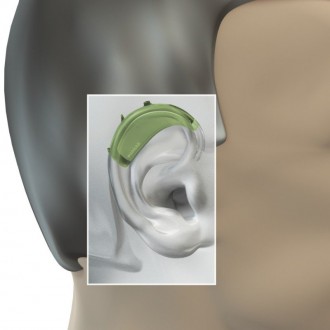 За последние несколько лет слуховые аппараты претерпели значительные изменения. . . фото 3