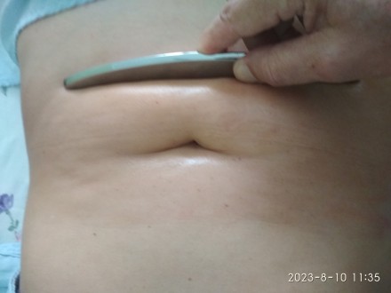 Реабілітолог з вищою освітою та досвідом роботи 10 років, виконує наступні масаж. . фото 5
