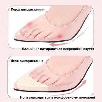 Вкладиші для пальців ніг у взуття з гострим носком бежеві. Вставки в взуття для . . фото 11
