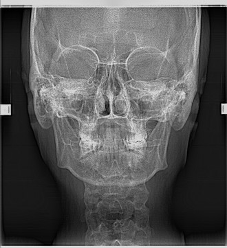 Ортопантомограф + Цефалостат від компанії МORITA - це дуже гарний апарат для вис. . фото 8