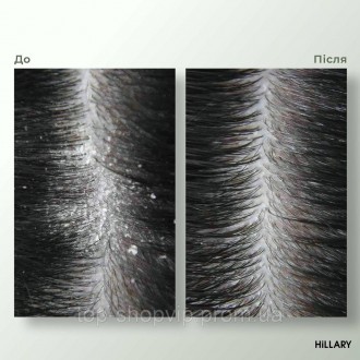 Ензимний пілінг для глибокого та водночас бережного очищення шкіри голови від на. . фото 8