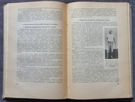 Нервные болезни. Е. К. Сепп, М. Б. Цукер, Е. В. Шмидт

Под общей редакцией зас. . фото 6