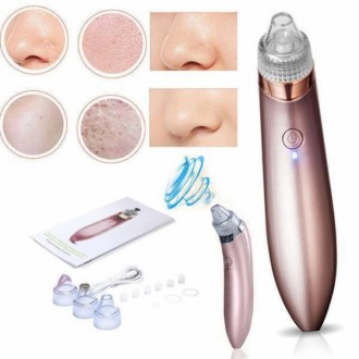 Вакуумный очиститель пор лица XN-8030 Beautiful skin care Specialist аппарат для. Одесса. фото 1 Вакуумный очиститель пор лица XN-8030 Beautiful skin care Specialist аппарат для. Одесса. фото 1