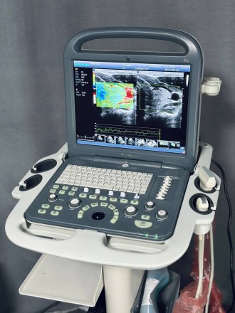 УЗИ/УЗД апарат SonoScape S2/ 2017/ 2x датчики/ Еластографія. Житомир. фото 1