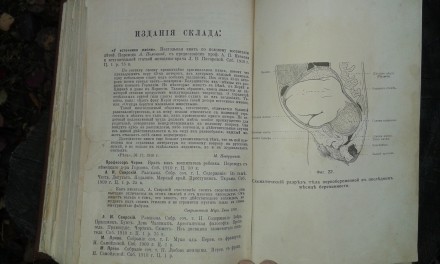 Книгу о медицине 1910 года(очень редкую),известного в те  годы Профессора Август. . фото 6
